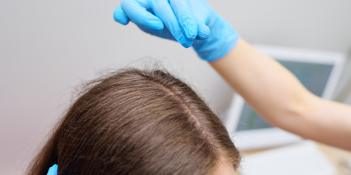Hair Shedding vs. Hair Loss What’s the Difference? — Love Wellness