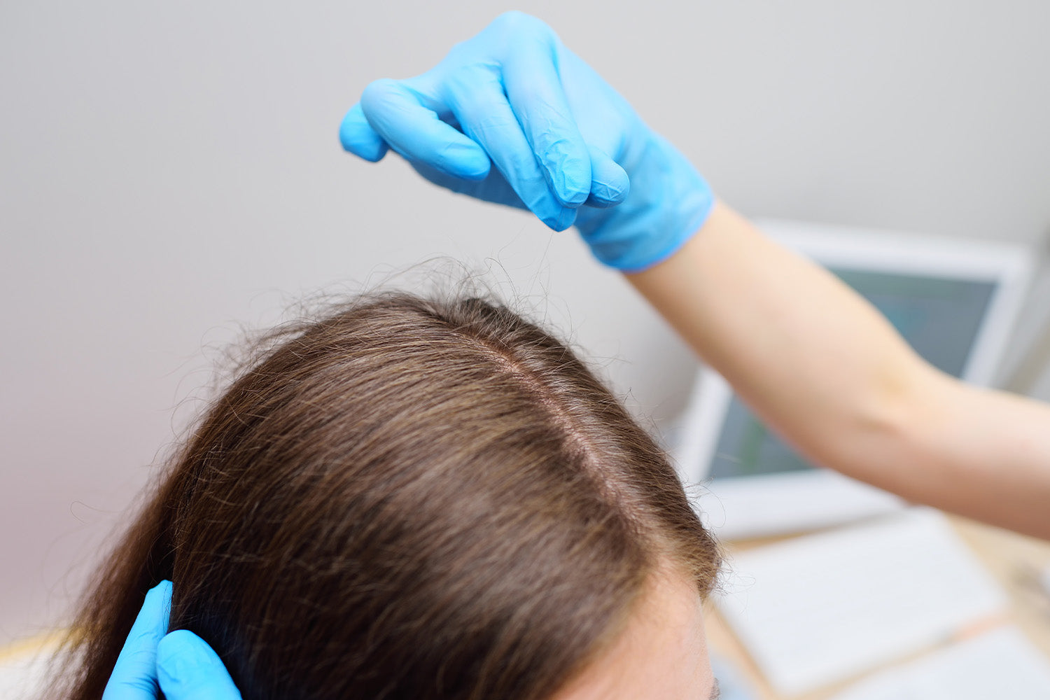 Hair Shedding vs. Hair Loss: What’s the Difference?
