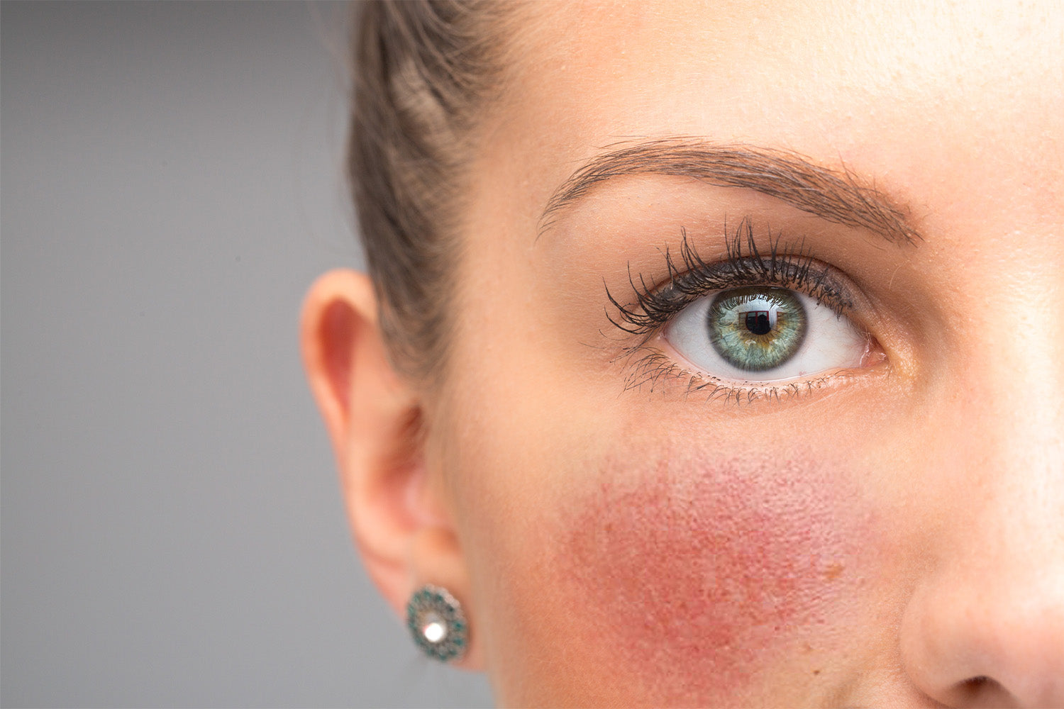 How To Get Rid of Redness on Your Face (Plus 4 Possible Causes)